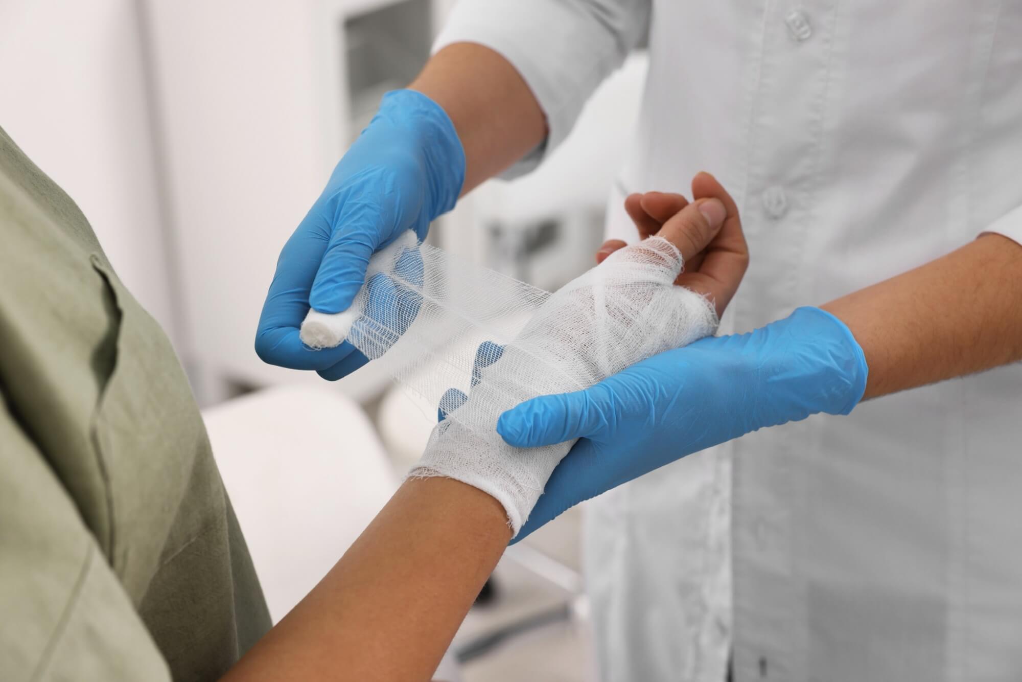Doctor bandaging patient's burned hand indoors, closeup
