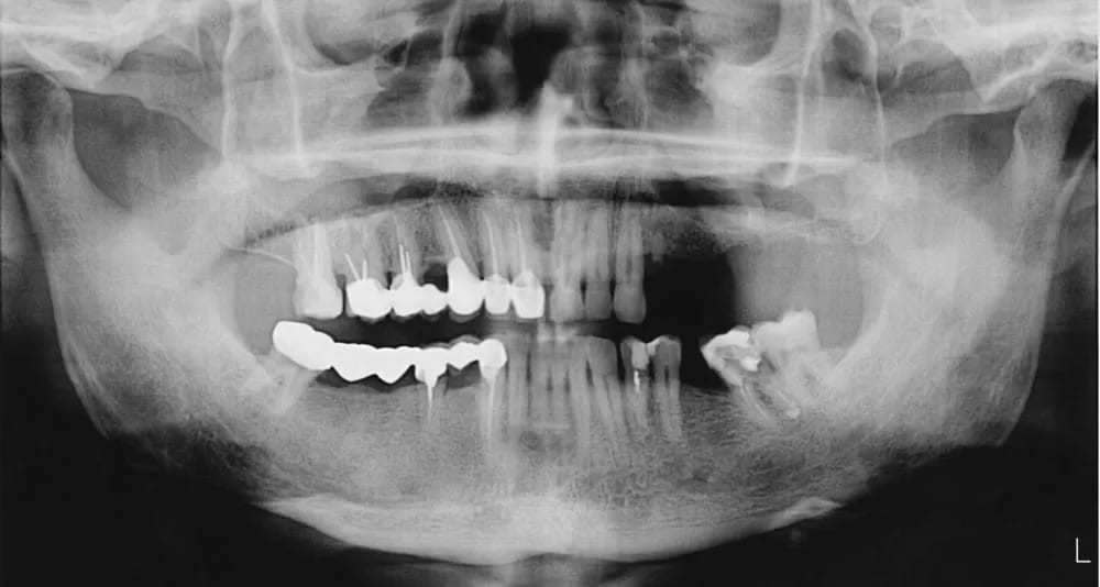 Cone-Beam and 3D Imaging