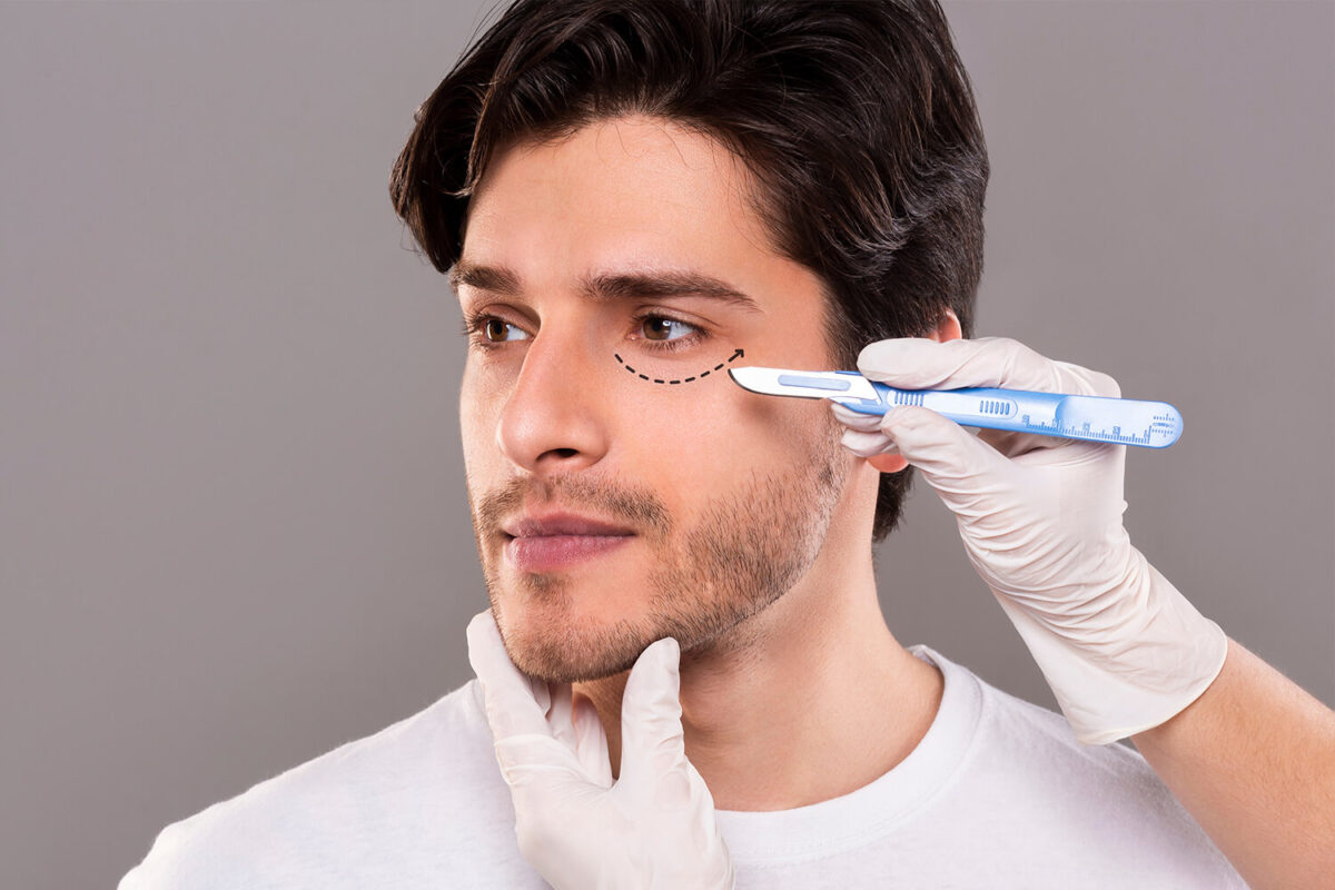 Blepharoplasty