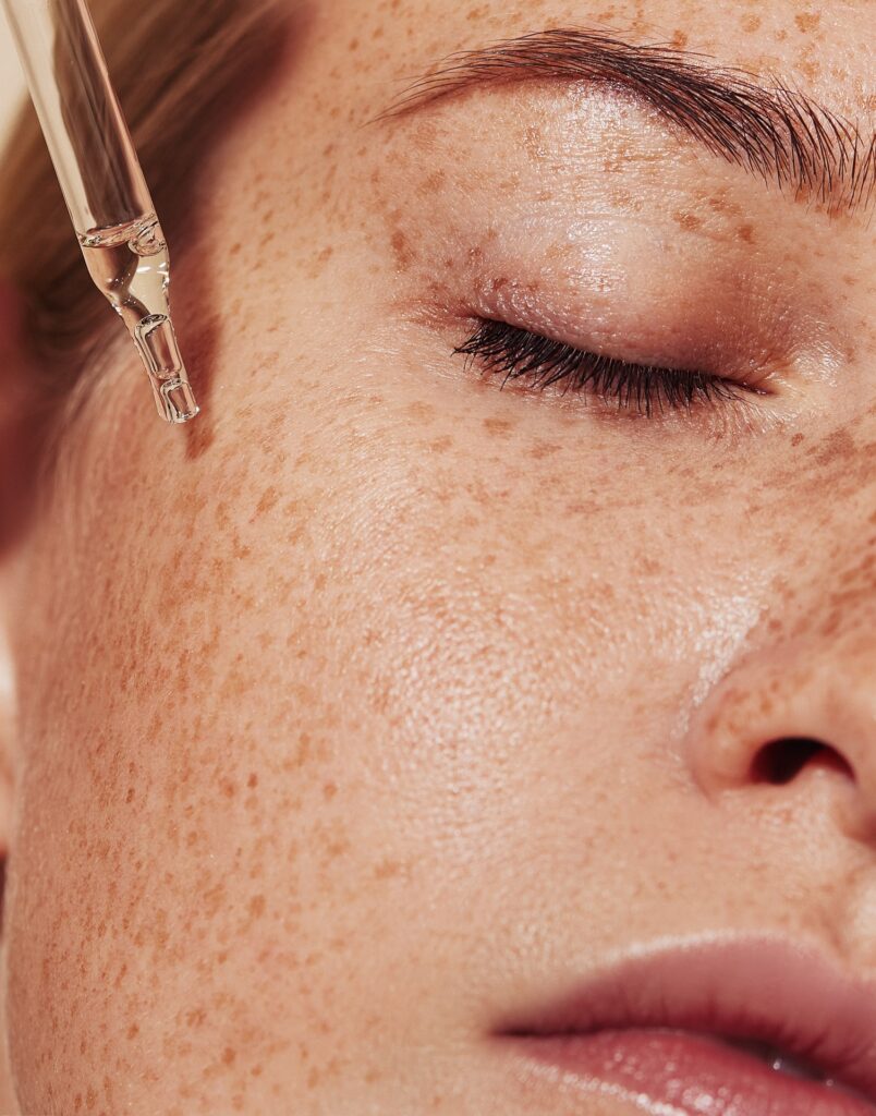 Close-up highly detailed shot of female skin with freckles and pipette with serum