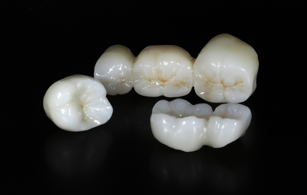 E-max and zirconium porcelain crowns with a natural tooth