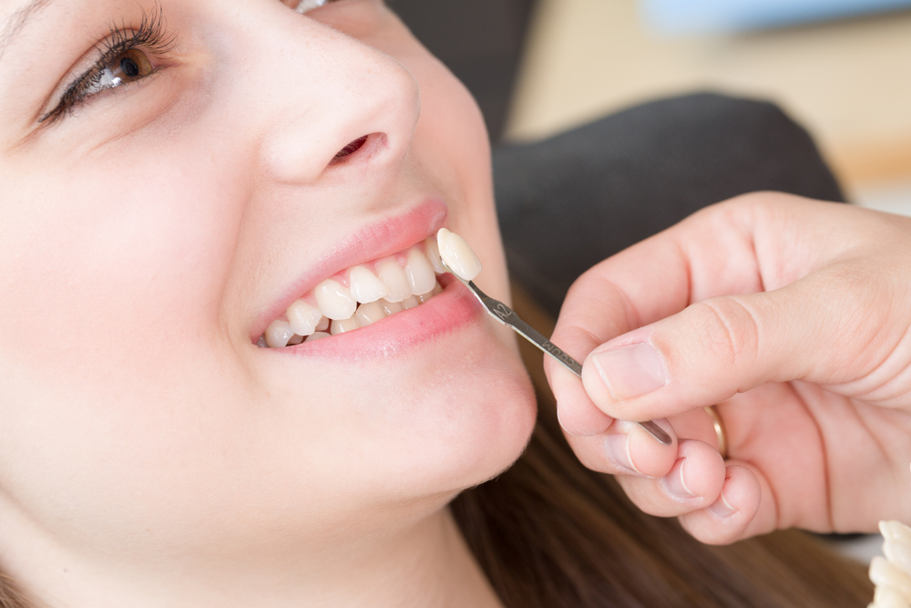 Check color of new tooth crown