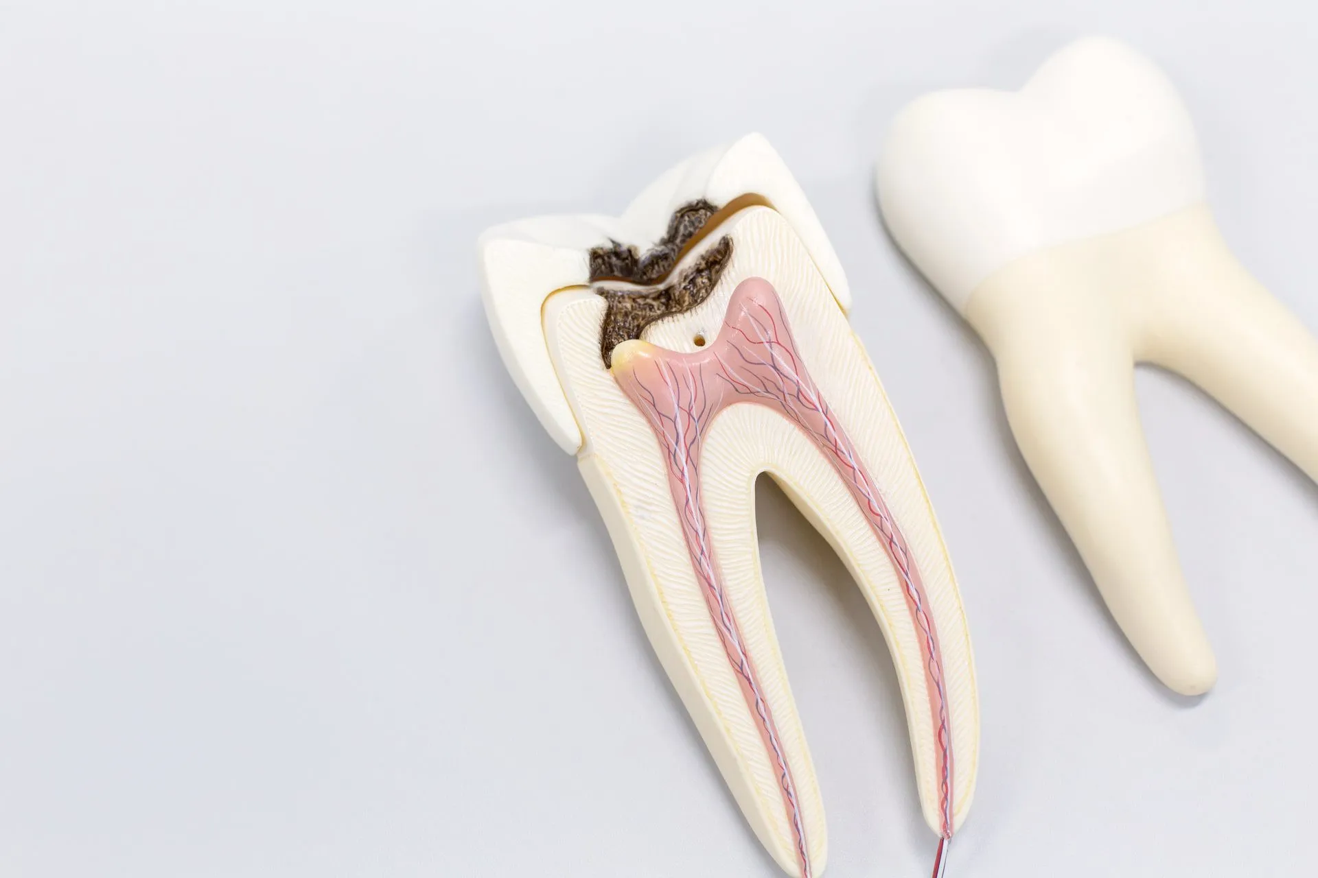 root-canals