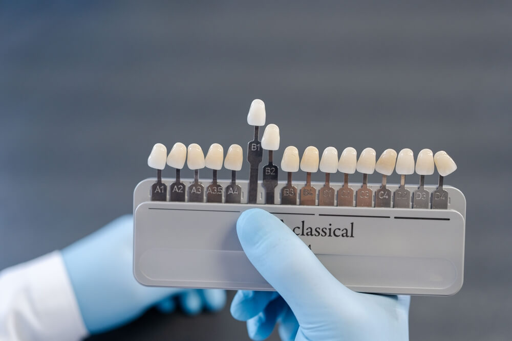 Dental technician hold palette of shades of teeth scale