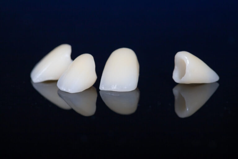 four dental crowns zirconia on a mirror table