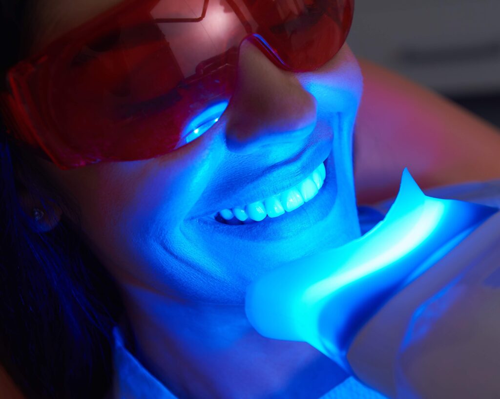 Professional Teeth Whitening in Cape Coral, FL
