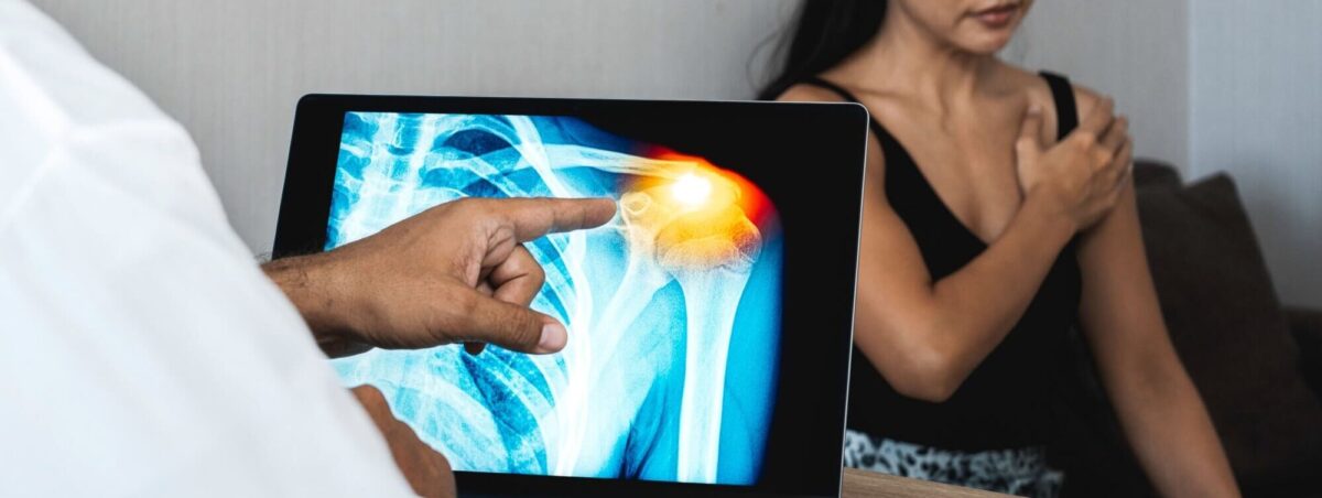 Doctor showing a x-ray of pain in the shoulder