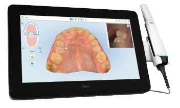 jaw scan image on computer tablet