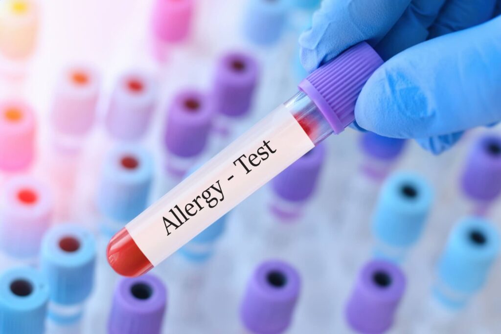 Doctor holding a test blood sample