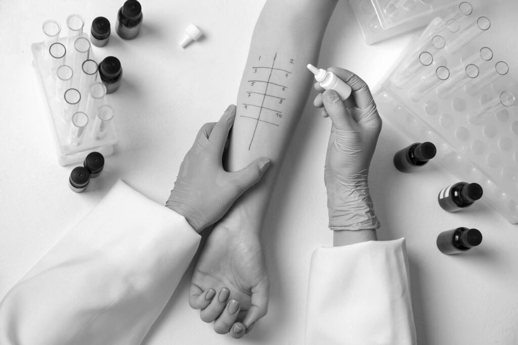 Doctor doing skin allergy test at light table