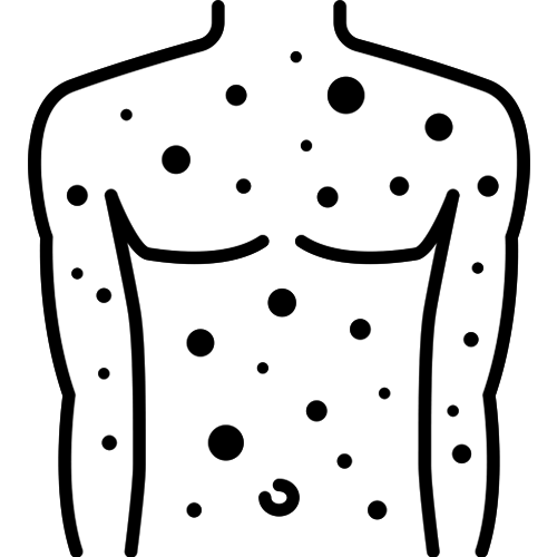 Eczema icon