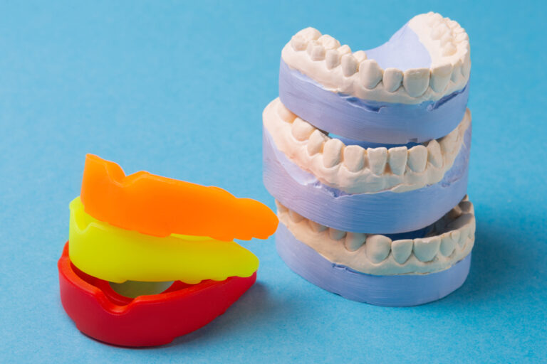 Three,Jaw,Casts,And,Three,Rubber,Mouth,Guards,,The,Concept