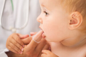 Close up of baby with open month getting teeth cleaned with baby toothbrush by dental professional