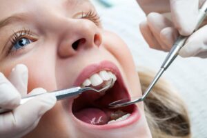 Close up of young girl getting teeth exam by dental professional