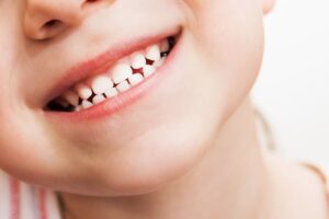 Close up of young boy's mouth showing baby teeth