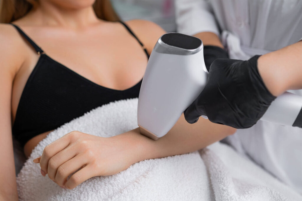 woman achieves hair-free arms through laser hair removal technology.