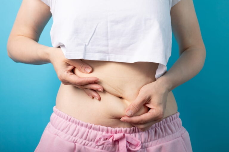 Obesity, woman touching fat belly, overweight person discussing liposuction and fitness options