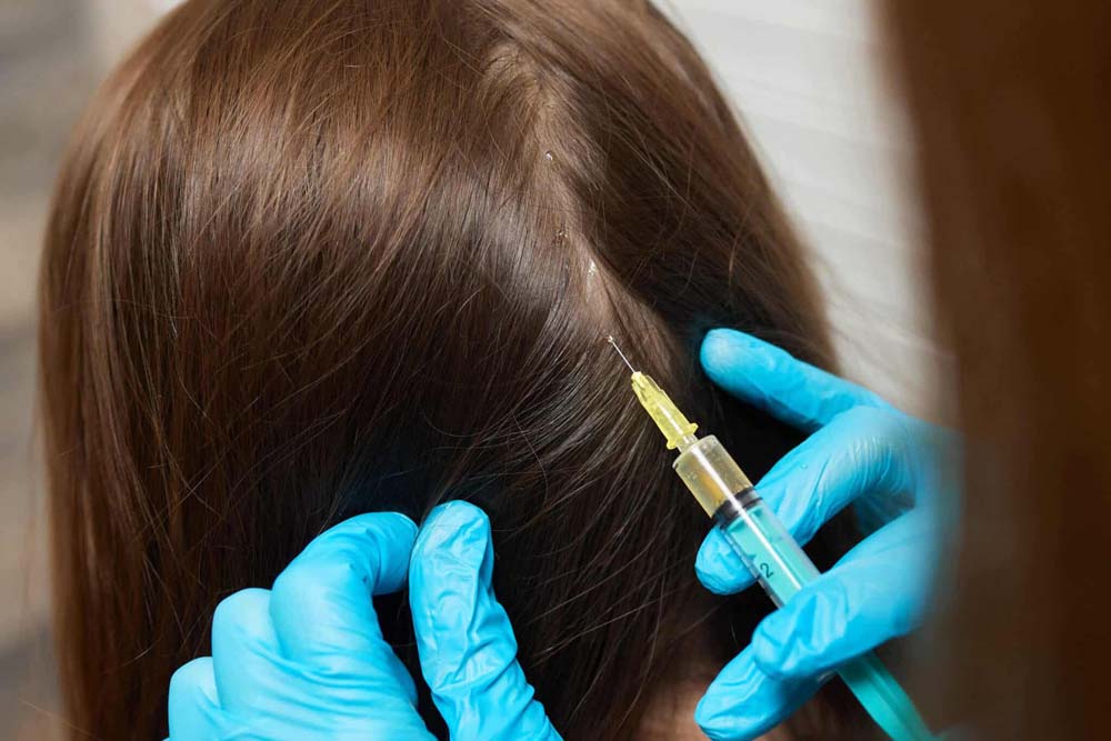 Woman getting Hair Regrowth treatment