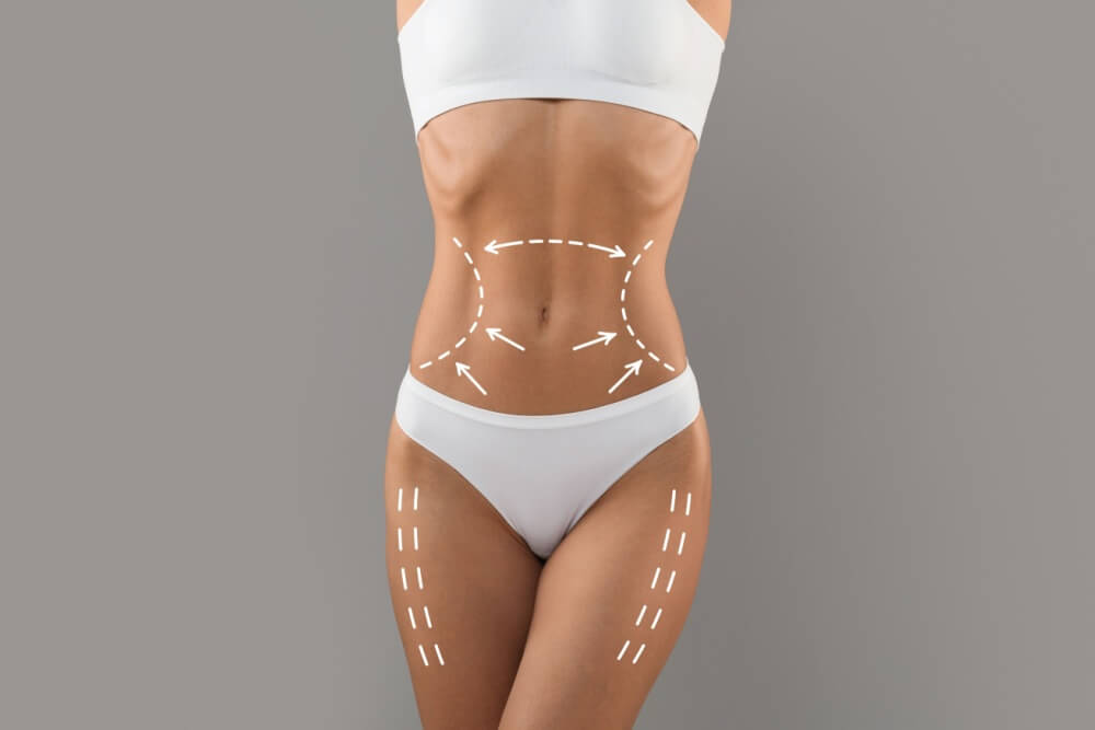 Slim Female Torso With Drawn Lifting Up Lines